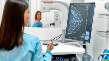 Mammoqrafiyanın effektiv xərçəng müayinə üsulu olduğu doğrudurmu? (rus dilində)